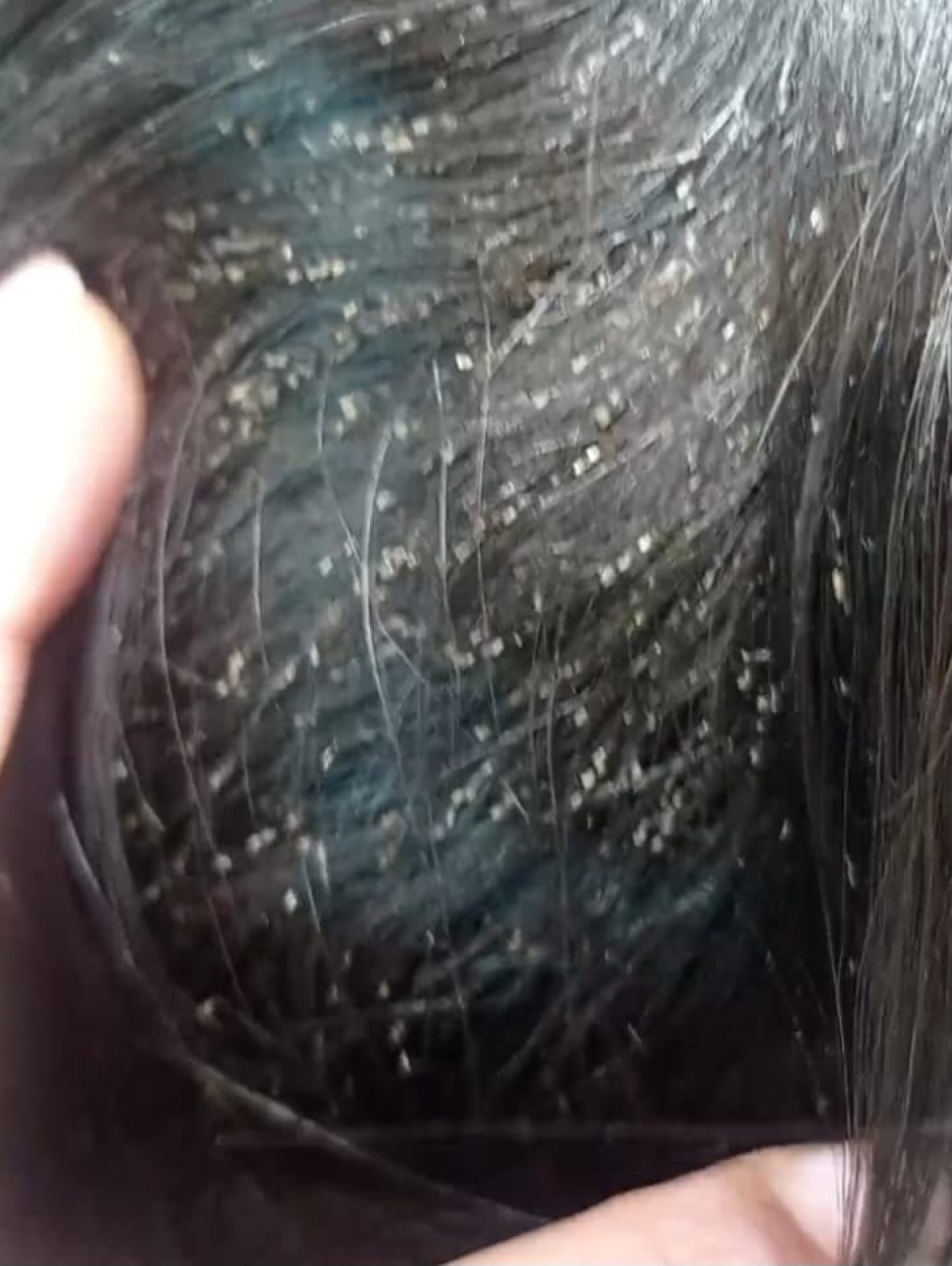 Antes y después Lice Cleaner